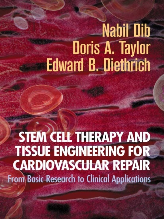 Stem Cell Therapy and Tissue Engineering for Cardiovascular Repair