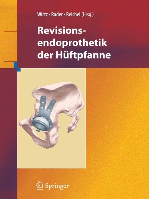 Revisionsendoprothetik der Hüftpfanne