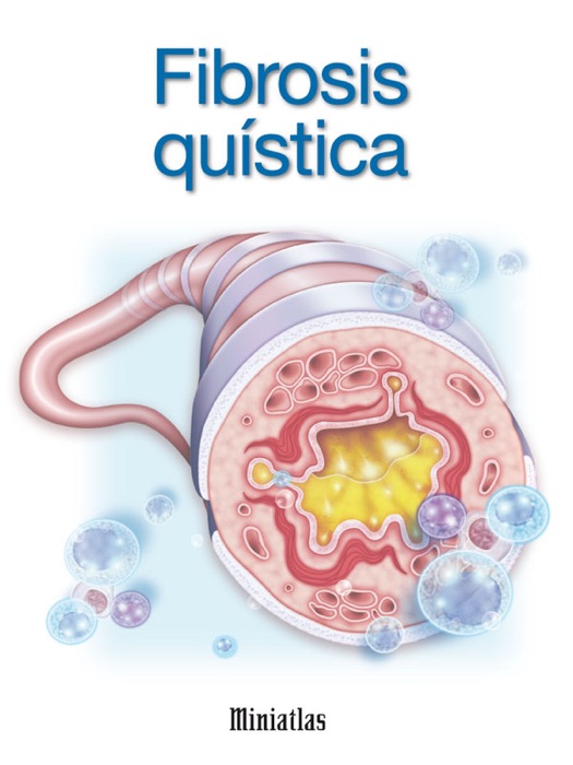 Miniatlas: Fibrosis quística