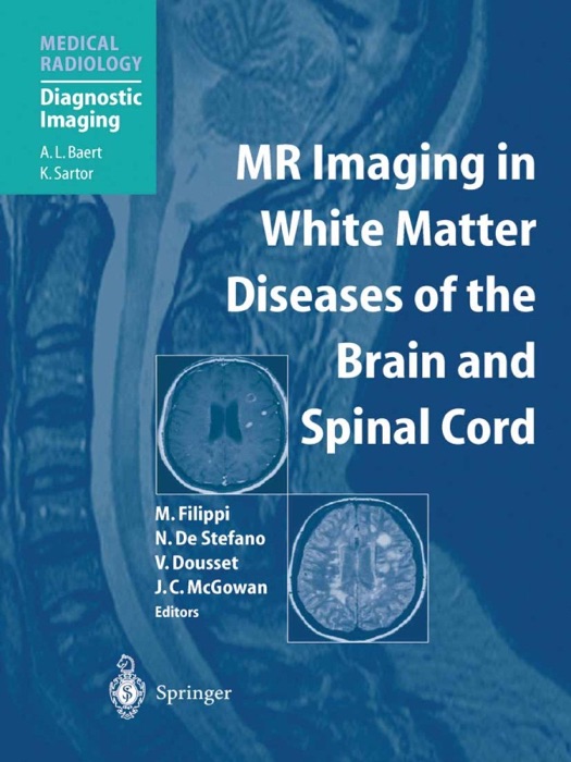 MR Imaging in White Matter Diseases of the Brain and Spinal Cord