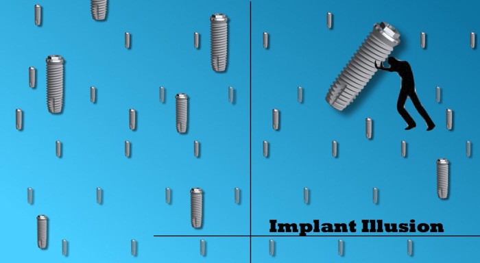 Implant illusion