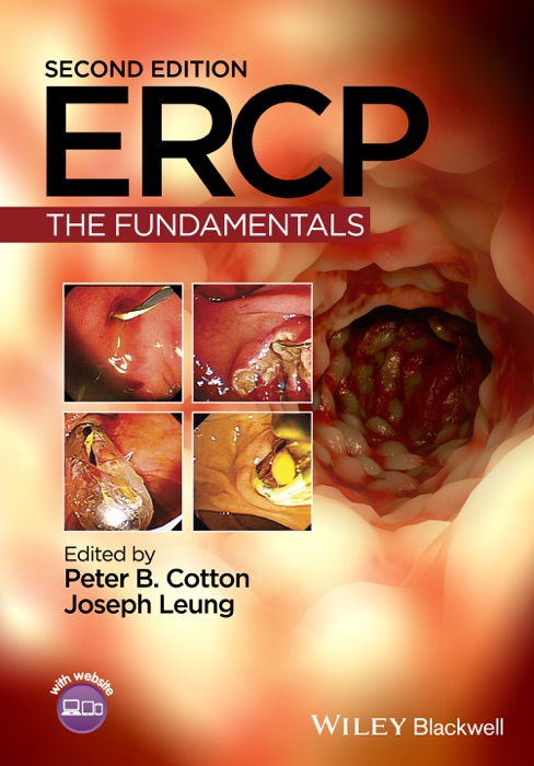 ERCP