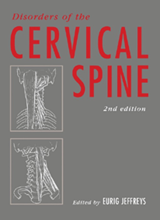 Disorders of the Cervical Spine