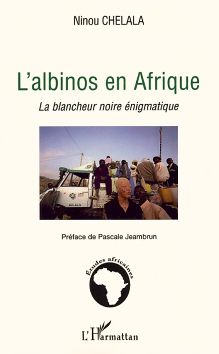 L’albinos en Afrique