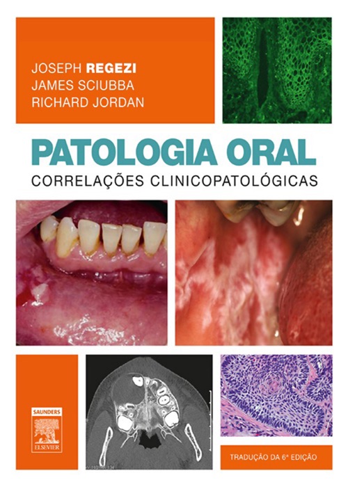 Patologia oral: 6ª Edição