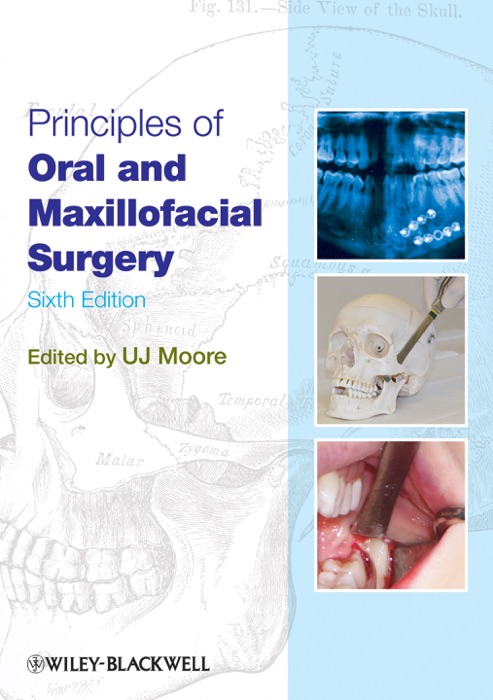 Principles of Oral and Maxillofacial Surgery