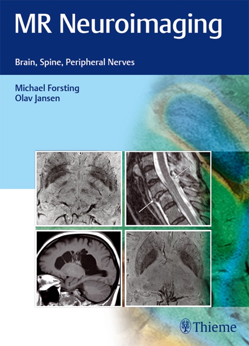 MR Neuroimaging