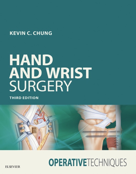 Operative Techniques: Hand and Wrist Surgery E-Book