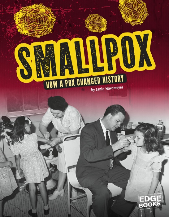 Smallpox