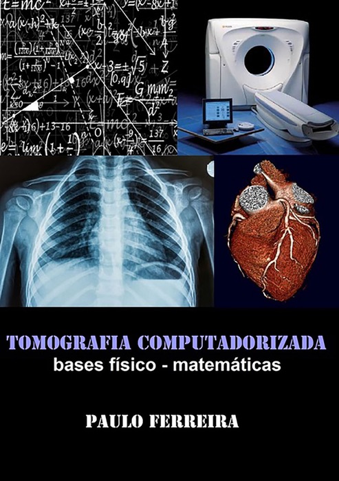 Tomografia Computadorizada: Bases Físico   Matemáticas