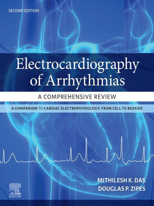 Electrocardiography of Arrhythmias: A Comprehensive Review E-Book