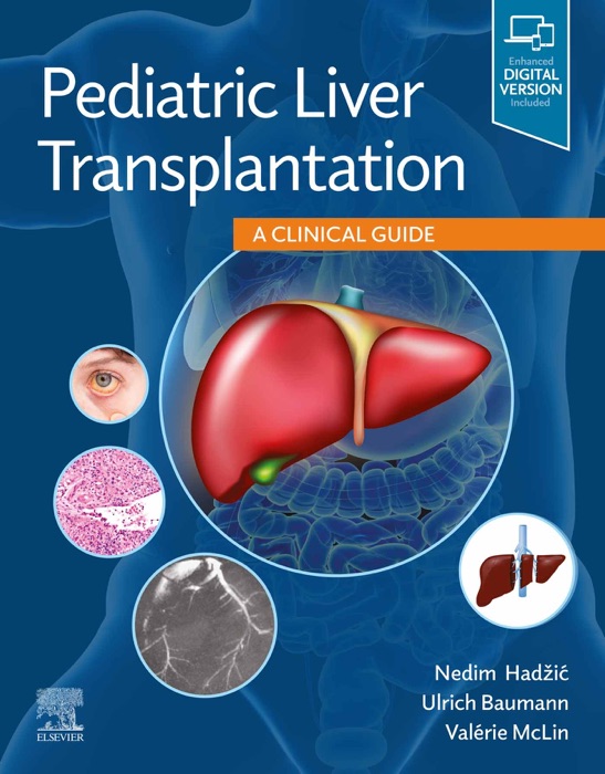 Pediatric Liver Transplantation E-Book