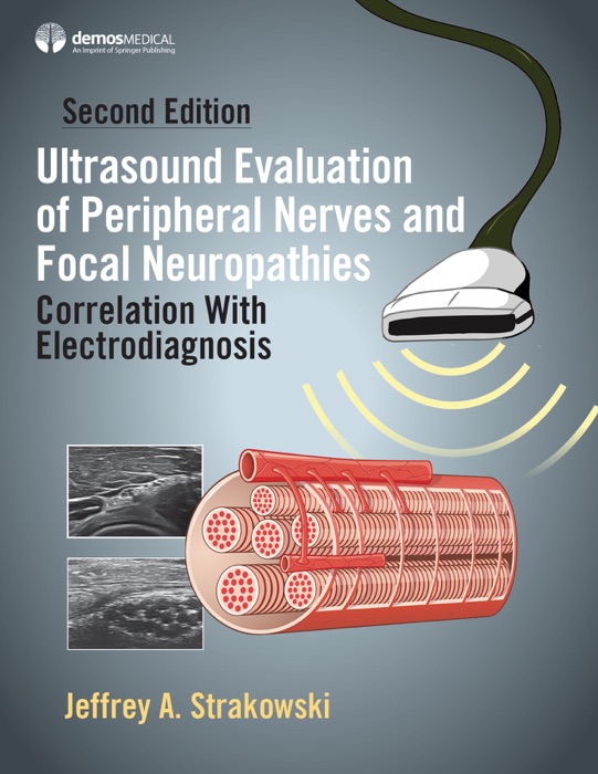 Ultrasound Evaluation of Peripheral Nerves and Focal Neuropathies, Second Edition