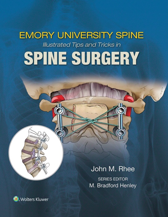 Illustrated Tips and Tricks in Spine Surgery