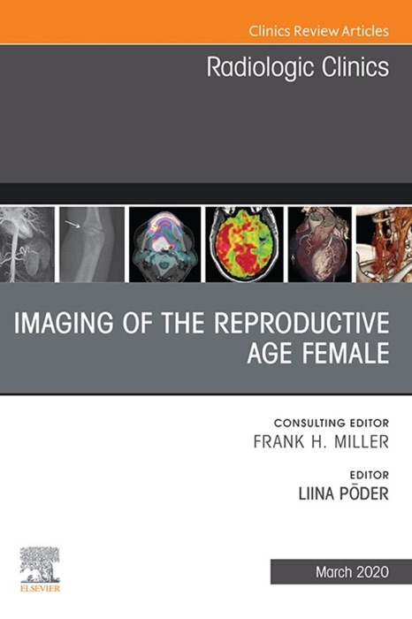 Imaging of the Reproductive Age Female,An Issue of Radiologic Clinics of North America E-Book