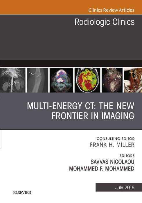 Multi-Energy CT: The New Frontier in Imaging, An Issue of Radiologic Clinics of North America, E-Book