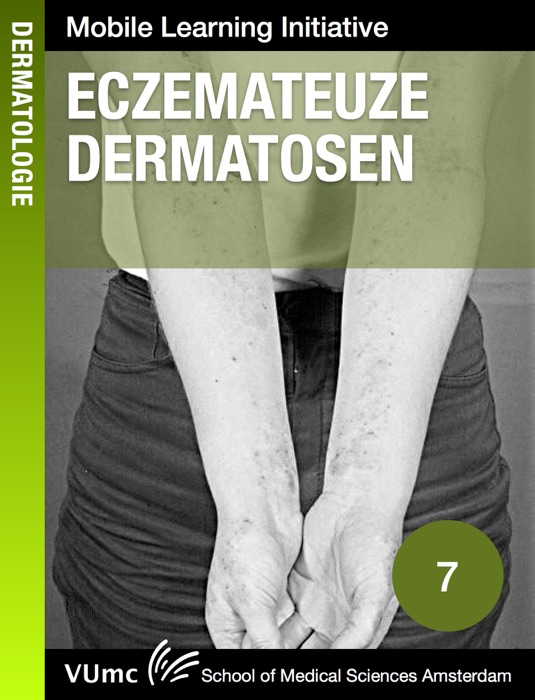 Eczemateuze dermatosen