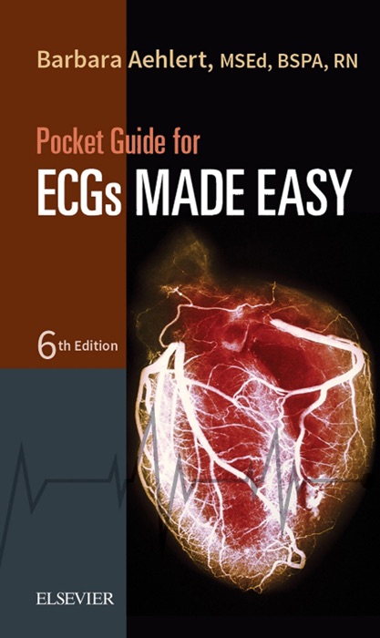 Pocket Guide for ECGs Made Easy