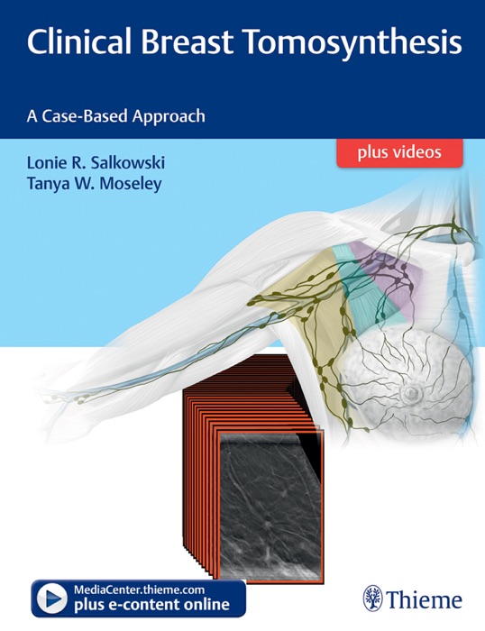 Clinical Breast Tomosynthesis