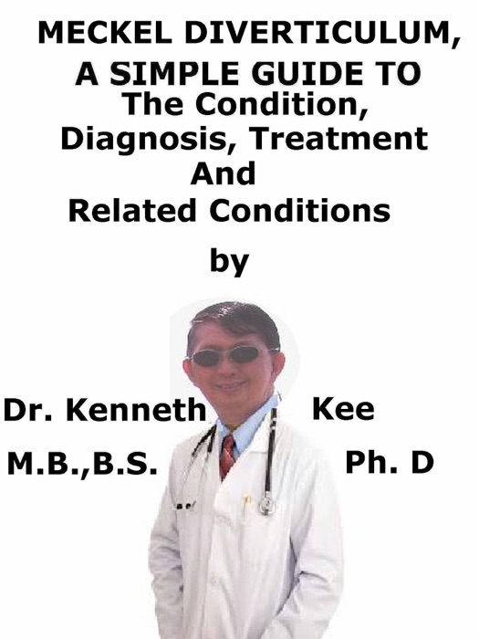 Meckel Diverticulum, A Simple Guide To The Condition, Diagnosis, Treatment And Related Conditions