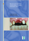 Reconstrucción de dientes endodonciados - Ernest Mallat Callís & Eee Labor Dental