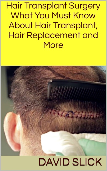 Hair Transplant Surgery