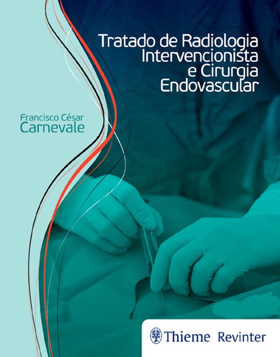 Download Tratado De Radiologia Intervencionista E Cirurgia Endovascular By Francisco César 4432