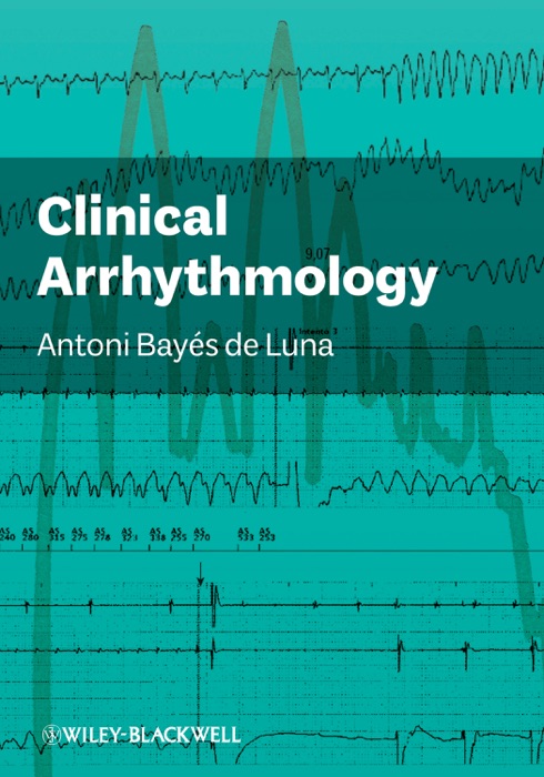 Clinical Arrhythmology