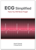 ECG Simplified - David Barold & Serge Barold