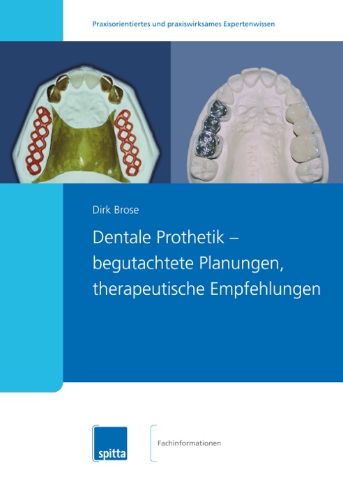 Dentale Prothetik ? begutachtete Planungen, therapeutische Empfehlungen