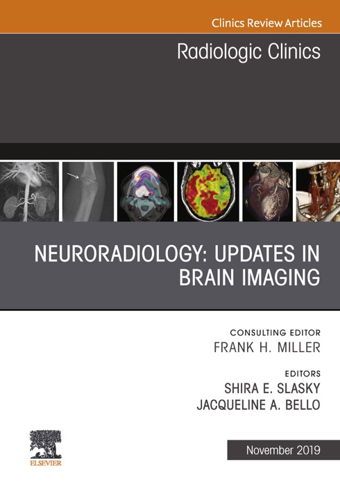 Neuroradiology, An Issue of Radiologic Clinics of North America E-Book