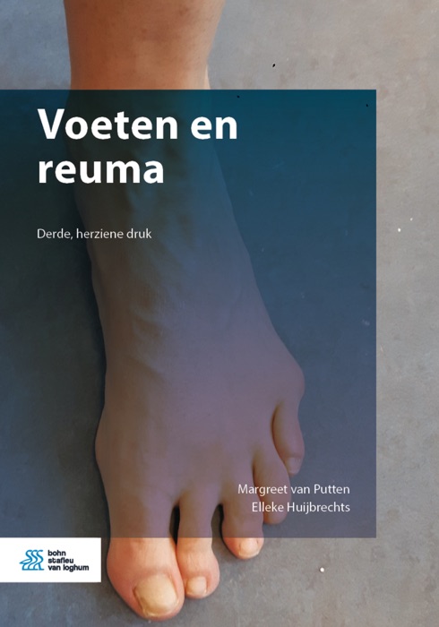 Voeten en reuma