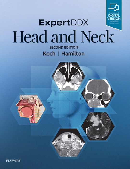 ExpertDDX: Head and Neck - E-Book