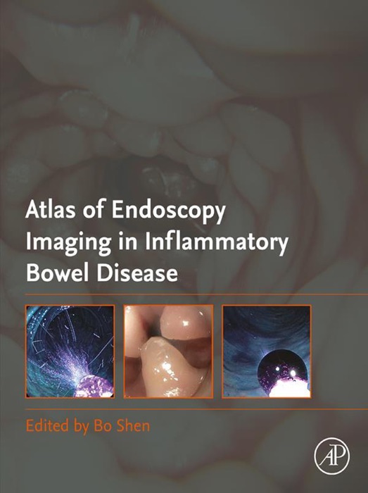 Atlas of Endoscopy Imaging in Inflammatory Bowel Disease (Enhanced Edition)