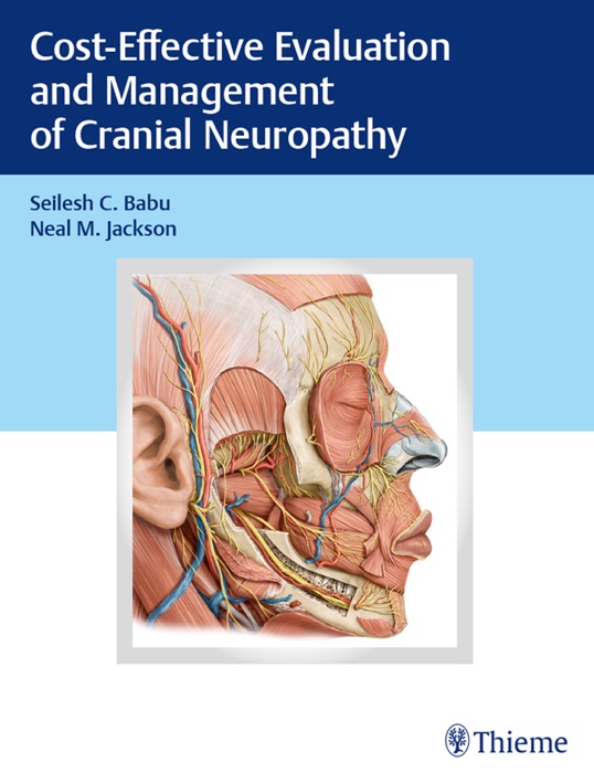 Cost-Effective Evaluation and Management of Cranial Neuropathy