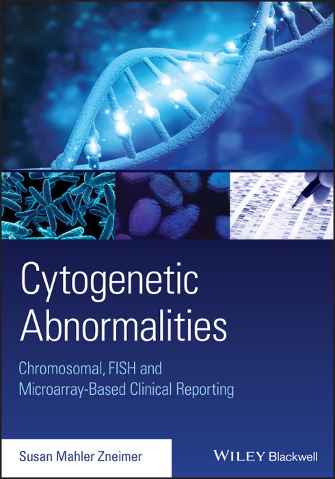 Cytogenetic Abnormalities