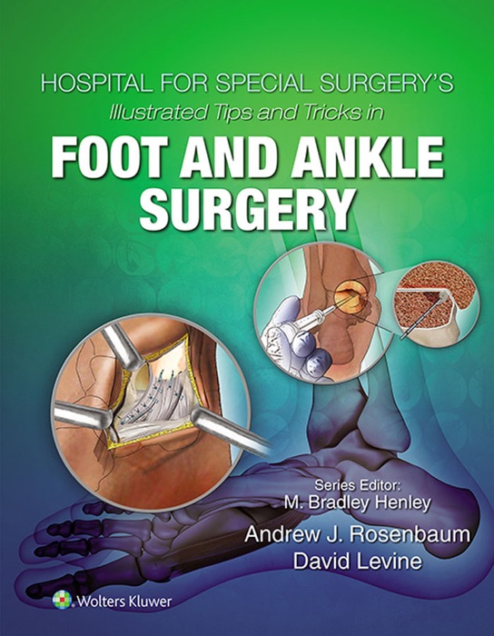 Hospital for Special Surgery’s Illustrated Tips and Tricks in Foot and Ankle Surgery