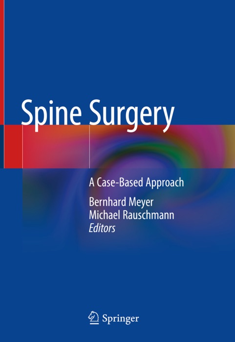 Spine Surgery