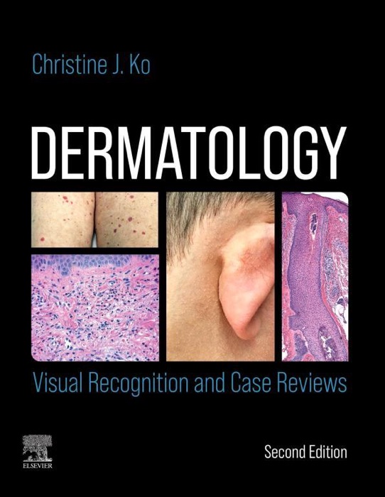 Dermatology: Visual Recognition and Case Reviews E-Book