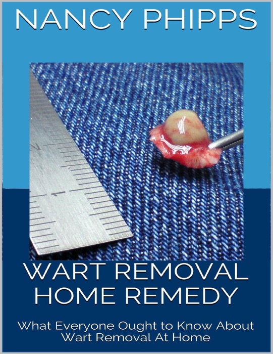 Wart Removal Home Remedy: What Everyone Ought to Know About Wart Removal At Home