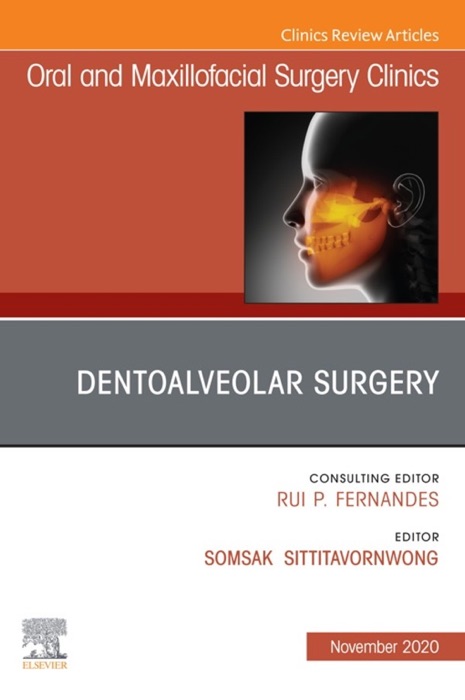 Dentoalveolar Surgery, An Issue of Oral and Maxillofacial Surgery Clinics of North America, E-Book