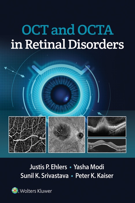 OCT and OCT Angiography in Retinal Disorders