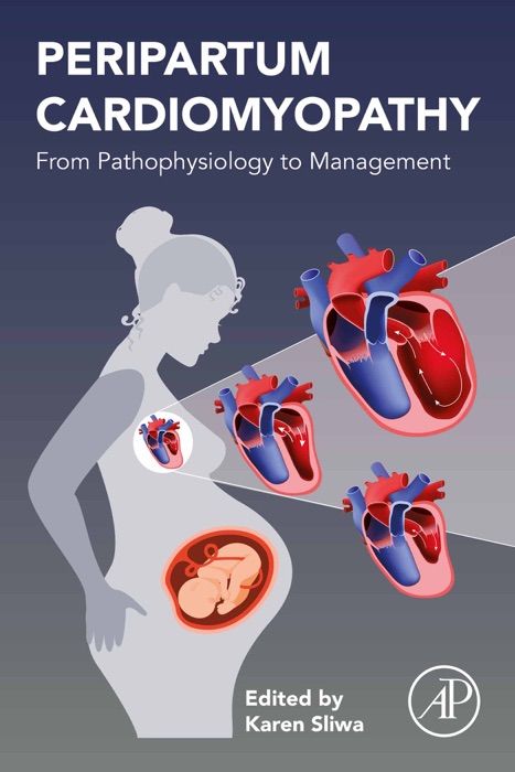 Peripartum Cardiomyopathy