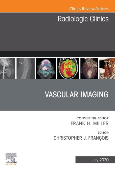Vascular Imaging, An Issue of Radiologic Clinics of North America, E-Book