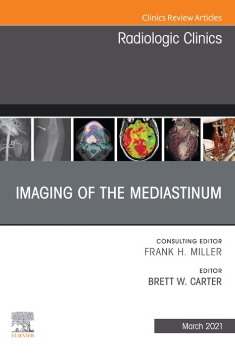 Imaging of the Mediastinum, An Issue of Radiologic Clinics of North America, E-Book