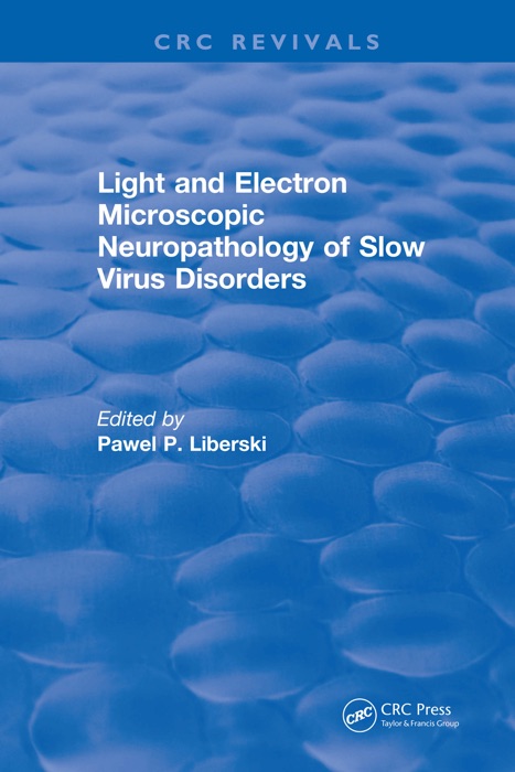 Light And Electron Microscopic Neuropathology of Slow Virus Disorders