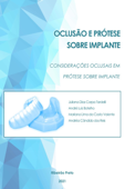 Considerações oclusais em prótese sobre implante - Juliana Dias Corpa Tardelli