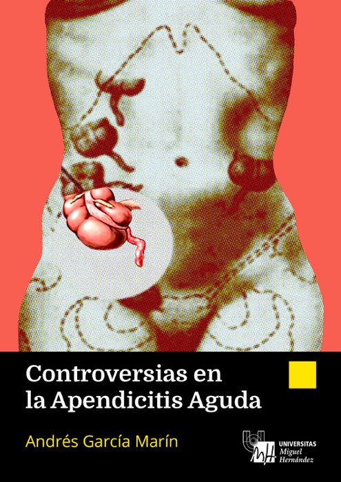 Controversias en la Apendicitis Aguda