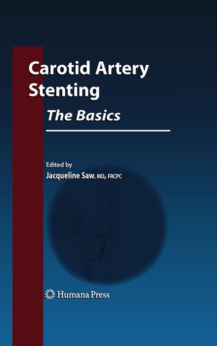 Carotid Artery Stenting: The Basics