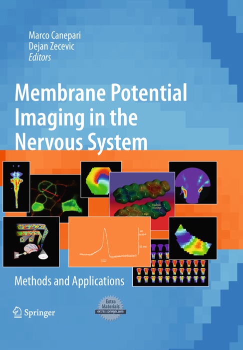 Membrane Potential Imaging in the Nervous System